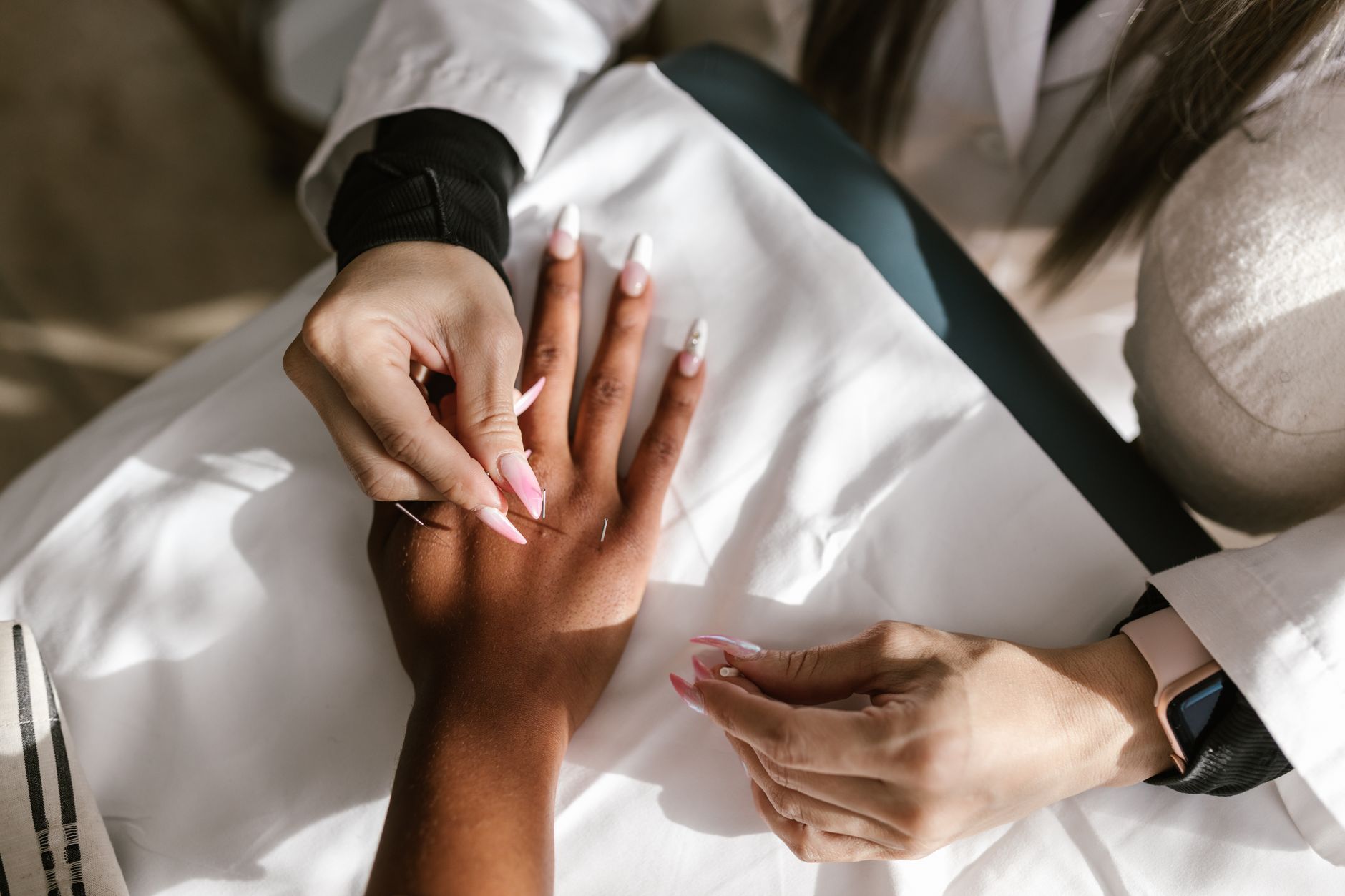 Dry Needling: What It Is and How It Works